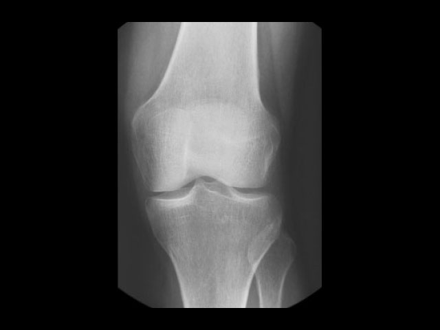 ακτινογραφία λαρισα