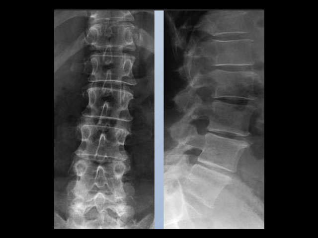 ακτινογραφία λαρισα