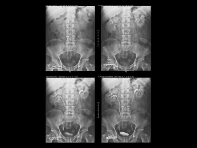 ακτινογραφία λαρισα