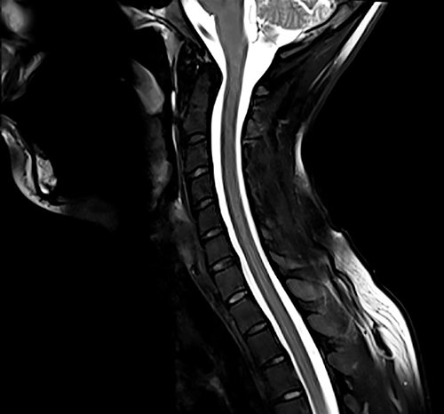 μαγνητικη τομογραφια