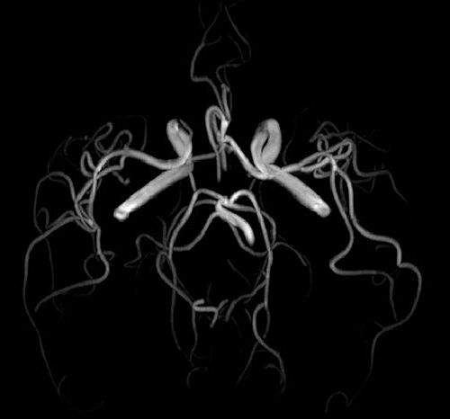 μαγνητικη τομογραφια