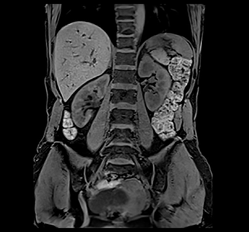 μαγνητικη τομογραφια