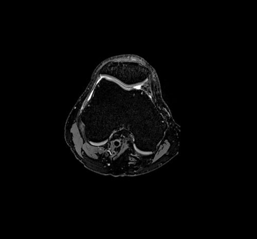 μαγνητικη τομογραφια